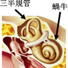 良性発作性頭位めまい症